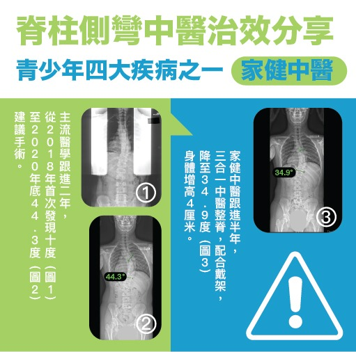 保守療法新療效